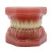 Dental Teeth Orthodontic Model - Study Tool for Teaching with Metal Bracket | International Shipping Available - Buy Online on GoSupps.com