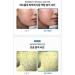 Buy Mediorga Spicule Cream Online - Best International Shipping & Quality Skincare - Buy Online on GoSupps.com