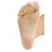 Silipos Felt Hammer Toe Crest 92910 - Large Right Foot (3 Pack) | Relief for Hammer, Claw, and Mallet Toes - Buy Online on GoSupps.com