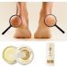 Foot Repair Cream - Exfoliating & Moisturizing Massage Peeling Cream for Smooth Whiter Feet | International Shipping - Buy Online on GoSupps.com