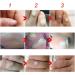 Tgoon Corn Remover Pads - Pain Relief & Skin Recovery Liquid - 8.5x2.5cm - Buy Online on GoSupps.com