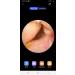 Newgen Medicals Earrkamera: WiFi Ear Cleaner with Full HD Camera Live App View & 8 Ear Tips - Ultimate Ear Health Solution - Buy Online on GoSupps.com