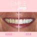 Smile Pop Teeth Whitening Pen - 18% Carbamide Peroxide Gel for Sensitive Teeth | Easy, Effective, Painless, Vegan & Non-Toxic Formula - Buy Online on GoSupps.com
