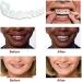 3 Pairs of Cosmetic Veneers - Instant Teeth Solution for Men & Women | Bad Tooth Whitening Alternative - Buy Online on GoSupps.com