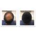FEBRON Spray Applicator Pump - Easy and Precise Hair Extension Application - Buy Online on GoSupps.com