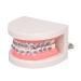 Dytah tooth orthodontic demonstration model demonstration teeth model treatment model with metal-arch wire explanatory model with brackets for teeth teach study model