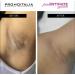 Promoitalia Pink Intimate System Lightening Gel - 3 mL VIAL - Buy Online on GoSupps.com