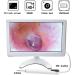 RKXKJ Ear Wax Removal Tool - Super Large 10.1 Inch IPS Screen Camera, 3.2mm Ear Scope, IPX6 Waterproof - Ear Care Solution - Buy Online on GoSupps.com