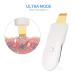 LIARTY Facial Skin Scrubber with Water Tank - Deep Cleansing Comedones Extractor - Buy Online on GoSupps.com