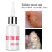 Corn Removal Plaster for Foot Corns, Calluses, Brittle Nails, and Cracked Heels - Buy Online on GoSupps.com