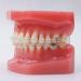Dental Typodont with Ceramic Brackets Orthodontic Braces Teeth Model - 28pcs for Teaching Practice - Buy Online on GoSupps.com