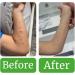 Naturasil for Molluscum - All Natural, Pain-Free Treatment for Children and Adults - Iodine Free - Made in USA | 15ml Bottle - Buy Online on GoSupps.com