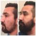 INVJOY Beard Growth Kit & VIKICON Beard Care Set | Top Beard Growth Products for Men - Derma Roller Serum Oil & Balm - Buy Online on GoSupps.com