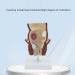 Humanly Rectal Hemorrhoid Lesions Anatomical Model Dilkpunkt Anal Anorectal - Buy Online on GoSupps.com