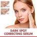  2Pcs Dark Spot Correcting Serum 10% Niacinamide+ 4% Tranexamic Acid Serum Ceramide Hyaluronic Acid Vitamin B12 natural color for Sensitive skin Fragrance-Free For Women Skin Care Serum 30ml/1fl.oz - Buy Online on GoSupps.com