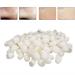 100 Pieces Silkworm Silk Peeling Balls - Effective Blackhead Removal Supplies for Facial Care - Buy Online on GoSupps.com