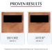 Eucerin Anti Pigment Eye Cream for Dark Circle Illuminating Eye Care Dark Circles Correction for All Skin Types 15ml - Buy Online on GoSupps.com
