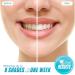 Dental Grade Teeth Whitening Kit with LED Light - 3 Carbamide Peroxide Gels, Sensitive Whitening Pen, Mouthpiece Tray - Buy Online on GoSupps.com