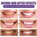Purple Teeth Whitening Powder Tooth Stain Removal Oral Powder for Teeth Whitening Teeth Whitening Booster 3pcs - Buy Online on GoSupps.com