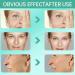 AOMEISA Anti-Acne Facial Serum Rejuvenate Oily Acne-Prone & Sensitive Skin International Shipping Available - Buy Online on GoSupps.com