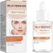 2024 New 1/2/3/4Pcs Milia Clearing Essence - Milia emover Eye Serum | Milia emover Milia Spot reatment | Miliary epair Essence | Moisturize Skin | Improve Skin Texture for All Skin Types - 30ml/1fl.oz (1pcs Milia Remover Serum)