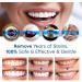 Teeth Whitening Essence Pen | Stain Remover for Brighter Teeth - Buy Online on GoSupps.com