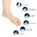 YUYTE Hallux Valgus Corrector Orthotic Braces for Bunion Alignment [Large] - Toe Separator for Men and Women - Buy Online on GoSupps.com