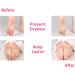 MICPANG Gel Heel Protectors for Plantar Fasciitis & Cracked Heel - Moisturizing Cushion Pads for Women and Men - Buy Online on GoSupps.com