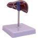 ARAZI Human Liver Pathology Model Visualization of Liver Lesions Clear Details Medical Teaching Props for Doctor-Patient Communication - Buy Online on GoSupps.com