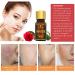 ALIVER Ultra Brightening Spotless Oil - Dark Spots, Age Spots, Hyperpigmentation, Stretch Marks - Skin Whitening Treatment - 2 Pack - Buy Online on GoSupps.com