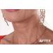 Nexsey Neck Tape - Lift, Tighten and Smooth Sagging Skin, Wrinkles, and Double Chin - Buy Online on GoSupps.com