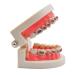 KFO Tooth Model Standard Tooth Teaching Malocclusion KFO Teeth Model with Brackets Archwire Tools