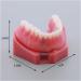 Fhuili Teeth Model for Education | Dental Implant Repair & Communication | Red Dentition Simulation Tool - Buy Online on GoSupps.com