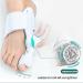 TPARIS 3D Knob Bunion Corrector - Hallux Valgus Correction with Mechanical Adjustment - Buy Online on GoSupps.com