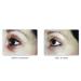 Anti Aging Eye Cream | Anti Wrinkle & Eye Care 15ml - LOVELY EYES by Elaine Perine | Made in Germany - Buy Online on GoSupps.com