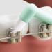 Soft Conical Toothbrush - Compact Interdental Cleaning Brush Set (8 Pieces 4 Colors) | International Shipping Available - Buy Online on GoSupps.com