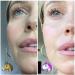 Spray R v lateur de Duvet Pr - pilation & Dermaplaning Visage Visibilit poils invisibles lissage peau protection anti-rougeurs 150 ml Vegan & Sans parfum Eliksir Maroka - Buy Online on GoSupps.com