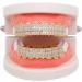 Gold-Plated Hip Hop Grillz - Diamond Tooth Decoration | Cold-Coated Copper Dental Bling for Parties & Halloween - Buy Online on GoSupps.com