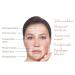 Skin-Remide Anti-Folds Transparent Glue Patches for Facial Lines - Forehead Smile Crow's Feet & Wrinkle Solution - Buy Online on GoSupps.com