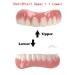 Instant Fake Teeth Dental Veneers for Temporary Tooth Restoration - Upper Jaw Veneers Dentures Socket | Denture Repair Kits - Fix Your Smile At Home! - Buy Online on GoSupps.com