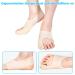 Soarfly Adjustable Hallux Valgus Correction Rail - Pain Relief Bandage for Day & Night Use | Non-Slip Heel Strap | Effective Treatment for Foot Problems - Buy Online on GoSupps.com