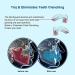 Kids Mouth Guard for Teeth Grinding - Pack of 4 Bite Guards + Dental Guard Case - Stop Clenching Bruxism - Teeth Whitening Tray & Sports - Moldable Bite Guards for 5-10 Year Olds - Buy Online on GoSupps.com