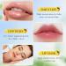 2PCs Set Vitamin E Honey Lip Mask Moisturizing Hydrating Lip Balm Relieve Dry & Chapped Lips Deeply Nourish Moisturize Lip Skin 13g*2 - Buy Online on GoSupps.com