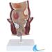 Rectum Model Human Pathological Diseases Rectum Ulcus Acne Pathological Model Use for Model Hemorrhoid Model Demonstration of Anorectal Diseases - Buy Online on GoSupps.com