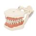High-scaled 32-teeth model with soft gums screw and solid gums for learning and practicing in dental training and further education by dentists