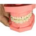 Ernzi Removable Dentures Model - Ideal Typodont for Dental Practice & Study Lessons - Buy Online on GoSupps.com