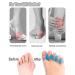 Alivonao Gel Toe Separators & Straighteners for Bunions, Hammer Toes - Universal Size (2 Pair) - Buy Online on GoSupps.com