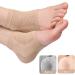 1 Pairs of Moisturizing Soft Gel Heel Socks Breathable Open Toe Socks for Dry Cracked Skin Hydrating Day and Night Care Skin Nude - Buy Online on GoSupps.com