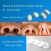 WoodyKnows Super-Defense Nasal Filters - 24 Pairs Replacement Filters (Round M) | 3-Pack for Ultimate Protection - Buy Online on GoSupps.com