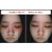 WHITESILK Expert Drop SCM Eye & Neck Lifting Ampoule - 10ml x 2 Vials - Buy Online on GoSupps.com